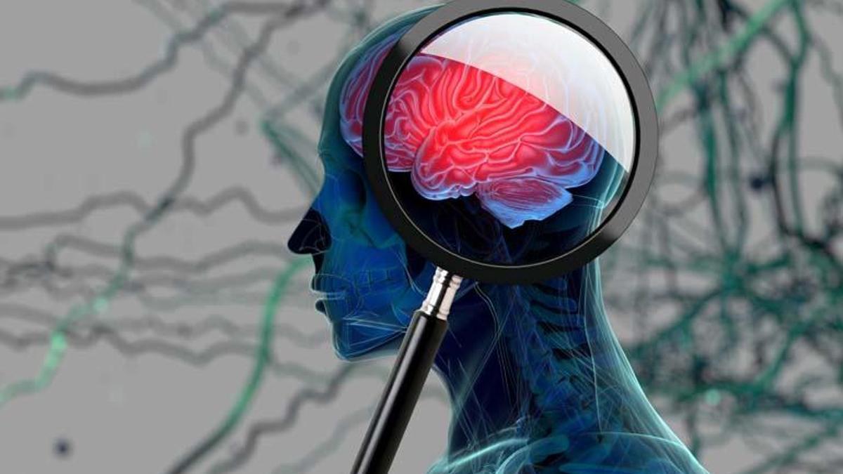 Zona aşısı demans riskini azaltıyor: Demans önlenebilir mi alzheimer tarih mi olacak? Fulya Soybaş yazdı